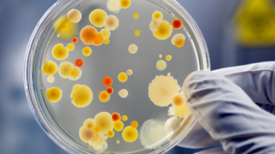 Microbiological Analysis